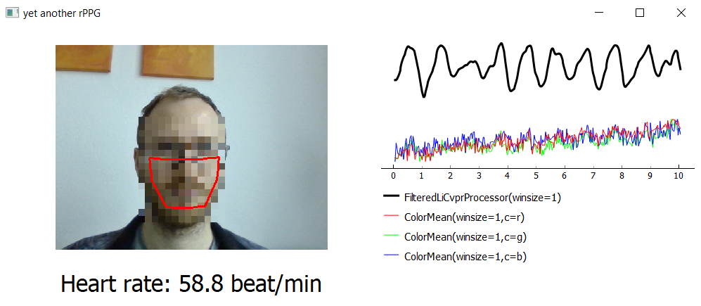 yarppg-screenshot /posts/yarppg/yarppg-intro/yarppg-screenshot.png